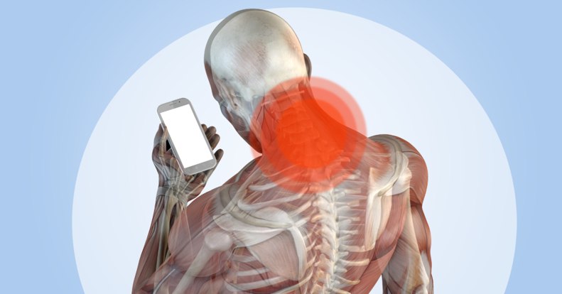 Mit jelent a mobilnyak? Ha sokat mobilozol, ezt nem árt tudnod!