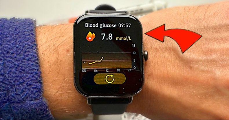 Az okosórák lehetnek a vércukorszint-mérés következő állomása, de azért még nagyon óvatosnak kell lenni ezen a téren